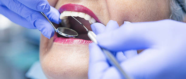 Best Emergency Root Canal Treatment in Alderton, WA